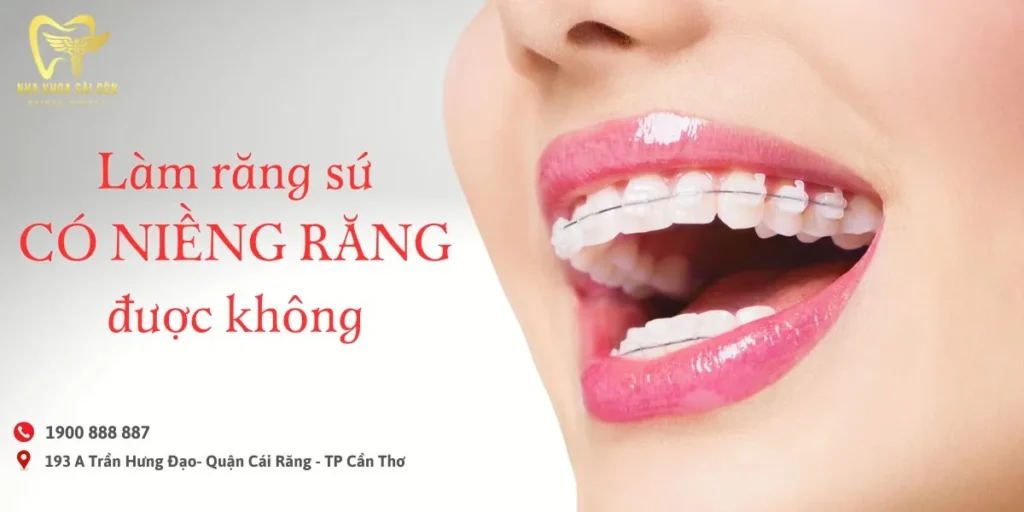 Làm Răng Sứ Có Niềng Răng Được Không ?