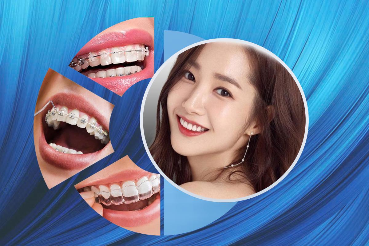 Niềng răng thẩm mỹ