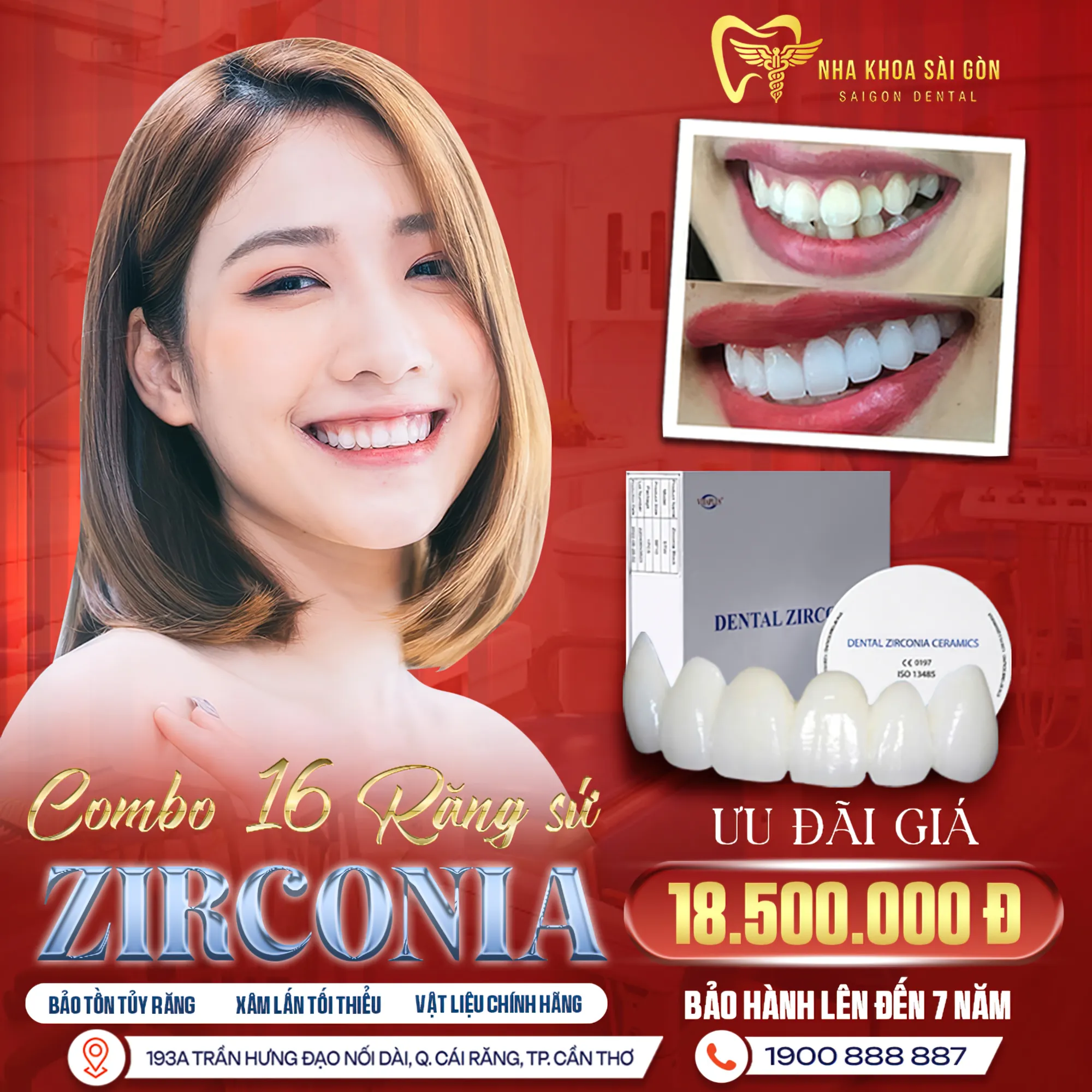 Răng sứ thẩm mỹ