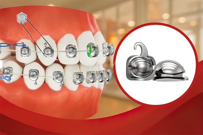 Công Nghệ Nhổ Răng Ghép PRF Nhanh Lành Thương Đã Có Tại Hệ Thống Nha Khoa Sài Gòn 3M