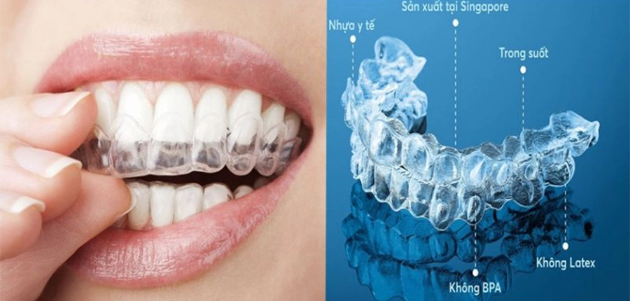 Khay Niềng Trong Suốt Thẩm Mỹ