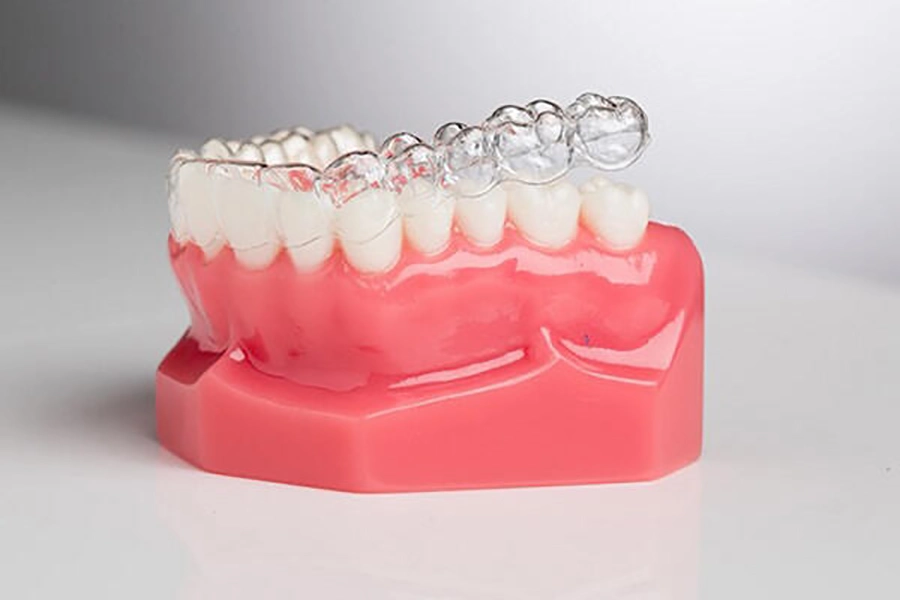 Niềng Răng Không Mắc Cài