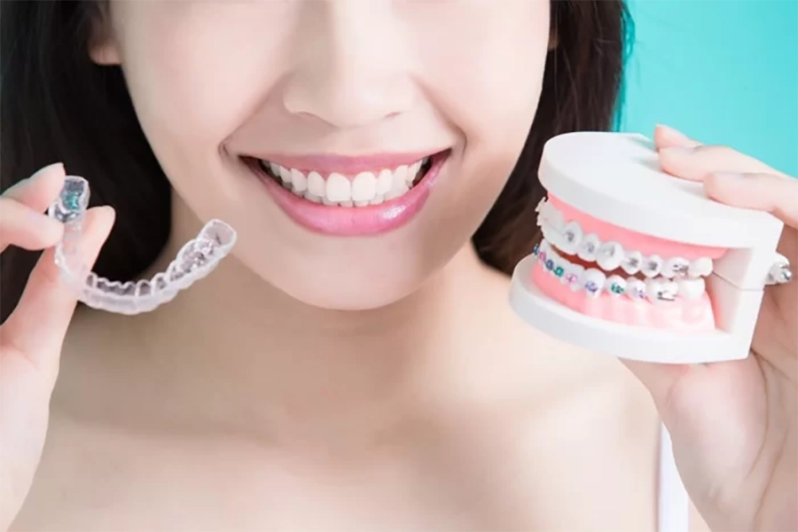 Niềng Răng Không Mắc Cài