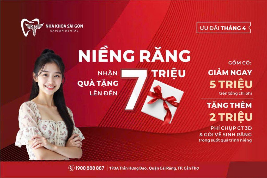 Siêu Khuyến Mãi Tháng 4: Niềng Răng Nhận Quà Tặng 7 Triệu