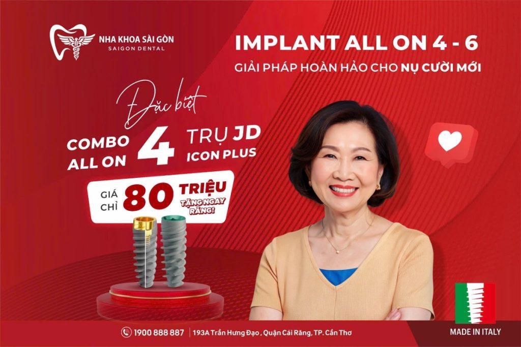 Khuyến Mãi Phục Hình All-On-4,6 Implant