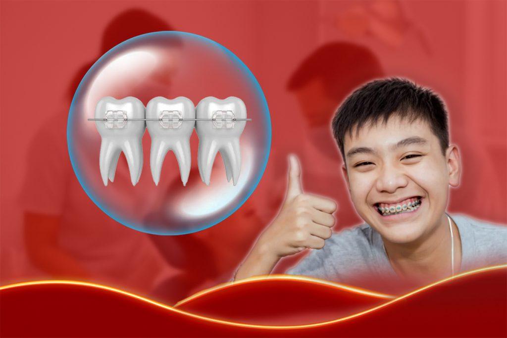 5 Lý Do Vàng Học Sinh, Sinh Viên Cần Niềng Răng Sớm Để Tỏa Sáng Nụ Cười