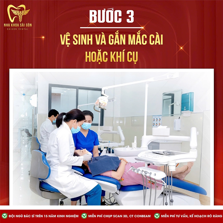 Quy Trình Niềng Răng Tại Nha Khoa Sài Gòn 3M: Bí Quyết Tự Tin Với Nụ Cười Hoàn Hảo