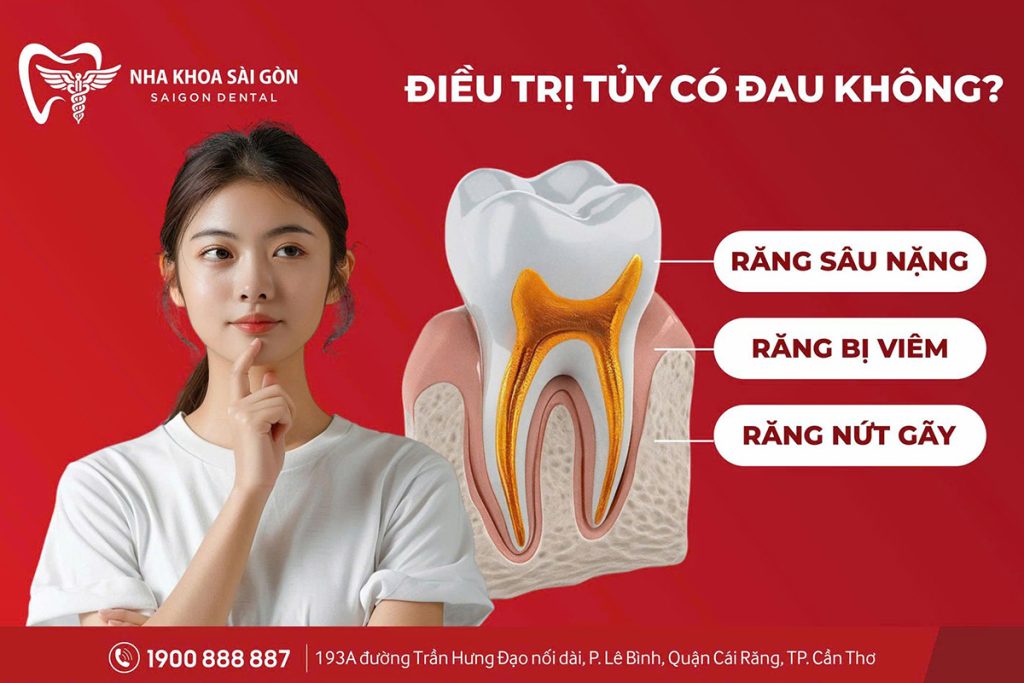 Điều Trị Tủy Có Đau Không?