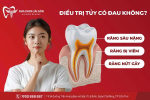 Điều Trị Tủy Có Đau Không?