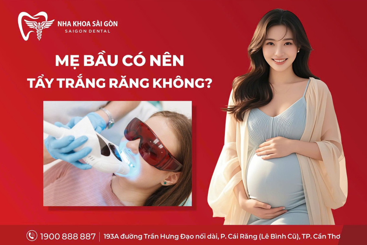 Mẹ Bầu Có Nên Tẩy Trắng Răng Không?