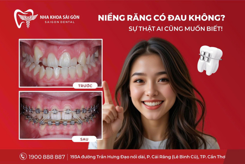 Niềng Răng Có Đau Không? Sự Thật Ai Cũng Muốn Biết!