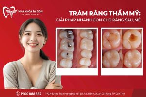 Trám răng thẩm mỹ: Giải pháp nhanh gọn cho răng sâu, mẻ