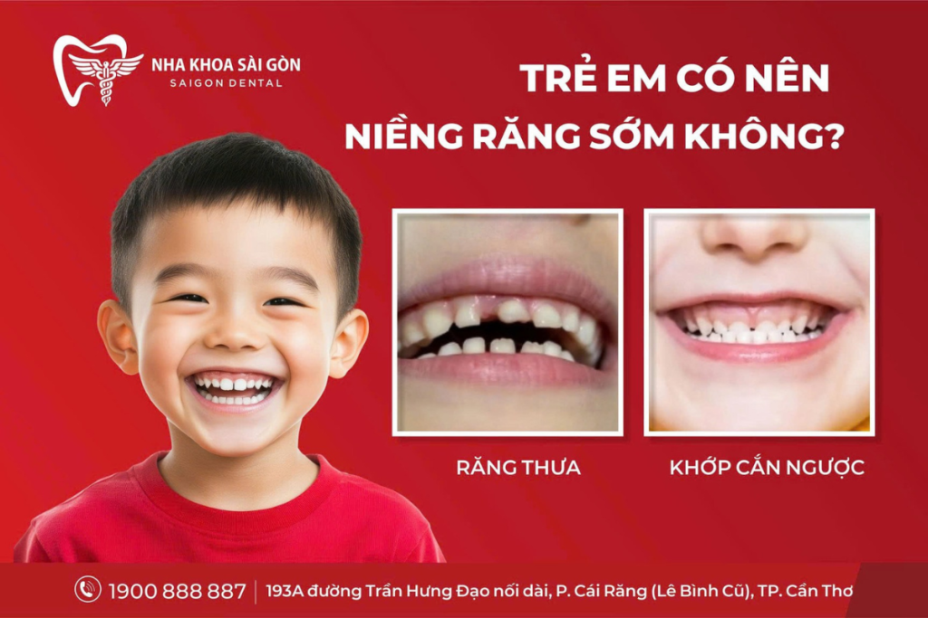 Trẻ Em Có Nên Niềng Răng Sớm Không?